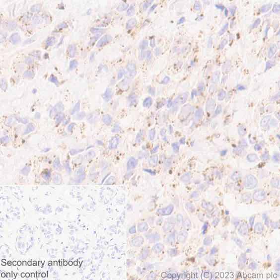 Immunohistochemistry (Formalin/PFA-fixed paraffin-embedded sections) - Anti-Niemann Pick C2 antibody [EPR19993-145-1] - BSA and Azide free (AB251560)