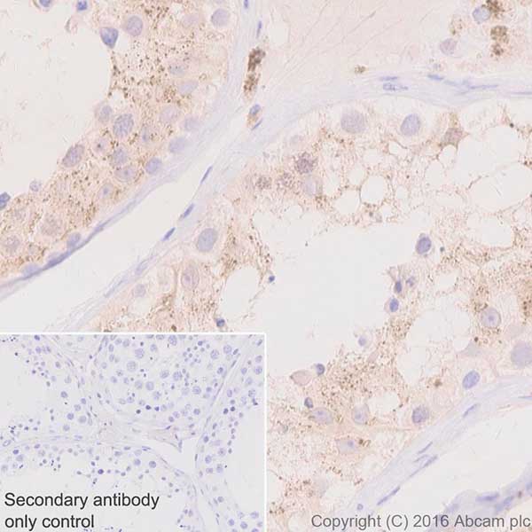 Immunohistochemistry (Formalin/PFA-fixed paraffin-embedded sections) - Anti-Niemann Pick C2 antibody [EPR19993-145-1] - BSA and Azide free (ab251560), expandable thumbnail