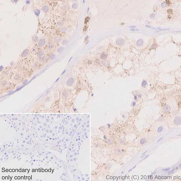 Immunohistochemistry (Formalin/PFA-fixed paraffin-embedded sections) - Anti-Niemann Pick C2 antibody [EPR19993-145-1] - BSA and Azide free (AB251560)