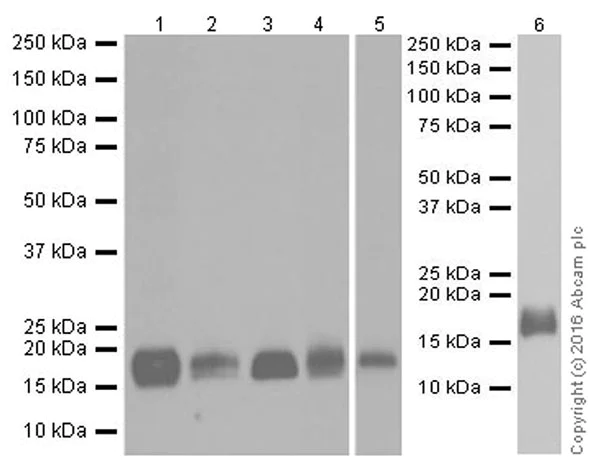 Western blot - Anti-Niemann Pick C2 antibody [EPR19993-145-1] - BSA and Azide free (AB251560)