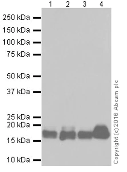 Western blot - Anti-Niemann Pick C2 antibody [EPR19993-145-1] - BSA and Azide free (AB251560)
