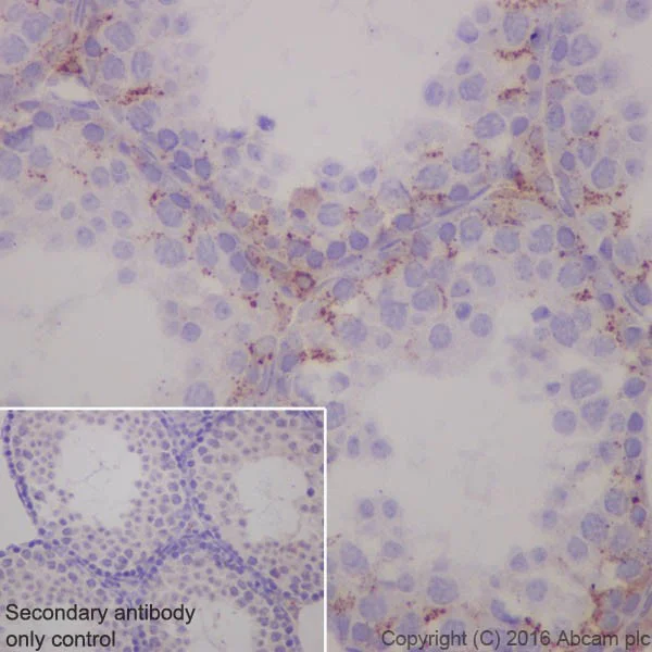 Immunohistochemistry (Formalin/PFA-fixed paraffin-embedded sections) - Anti-Niemann Pick C2 antibody [EPR19993] (AB207158)