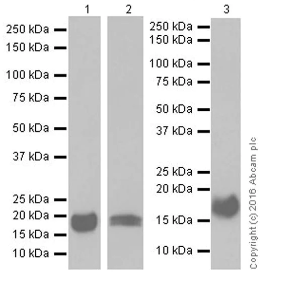 Western blot - Anti-Niemann Pick C2 antibody [EPR19993] (AB207158)