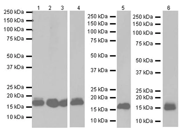 Western blot - Anti-Niemann Pick C2 antibody [EPR19993] (AB207158)