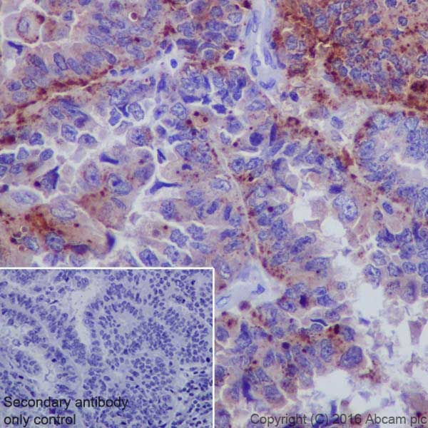 Immunohistochemistry (Formalin/PFA-fixed paraffin-embedded sections) - Anti-Niemann Pick C2 antibody [EPR19993] - Low endotoxin, Azide free (AB223550), expandable thumbnail