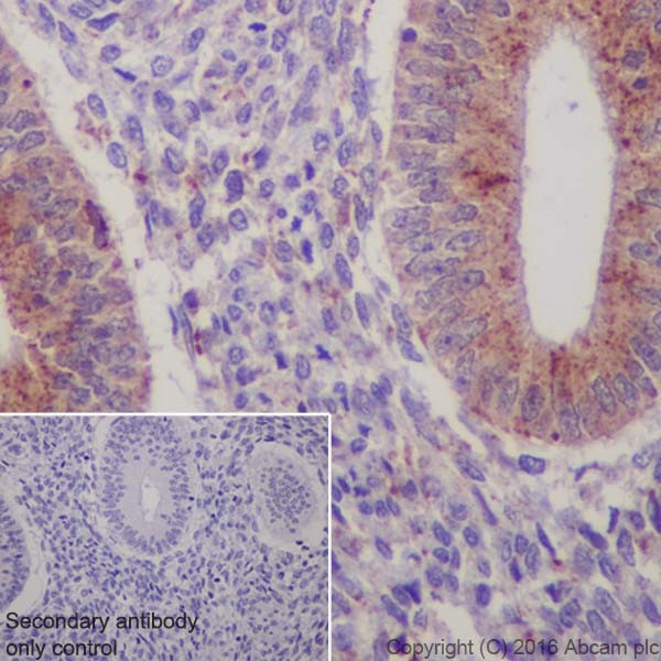Immunohistochemistry (Formalin/PFA-fixed paraffin-embedded sections) - Anti-Niemann Pick C2 antibody [EPR19993] - Low endotoxin, Azide free (AB223550), expandable thumbnail
