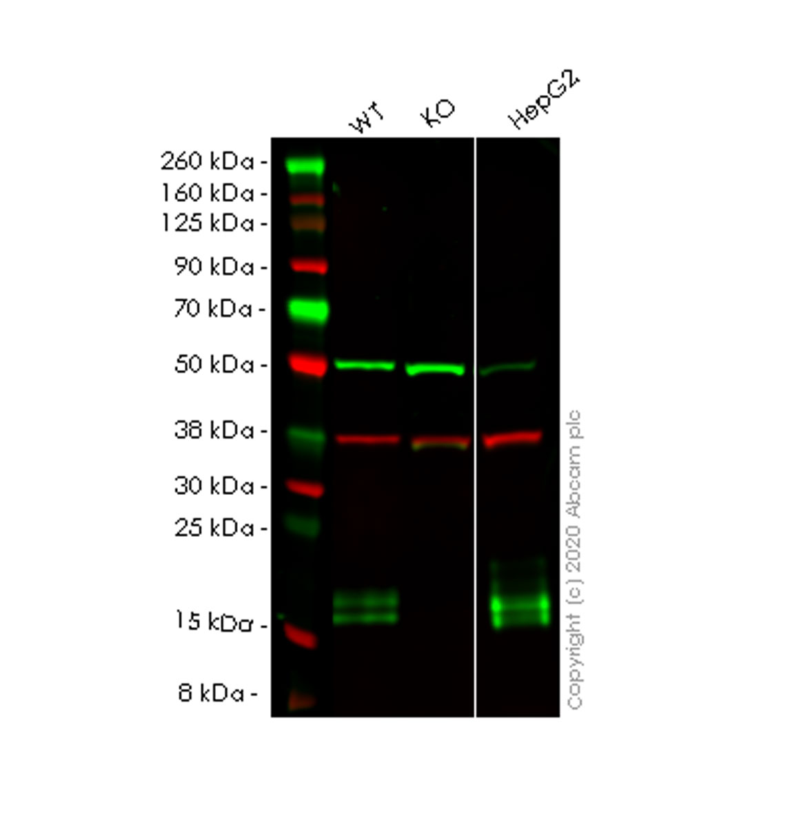 Western blot - Anti-Niemann Pick C2 antibody [EPR19993] - Low endotoxin, Azide free (AB223550), expandable thumbnail