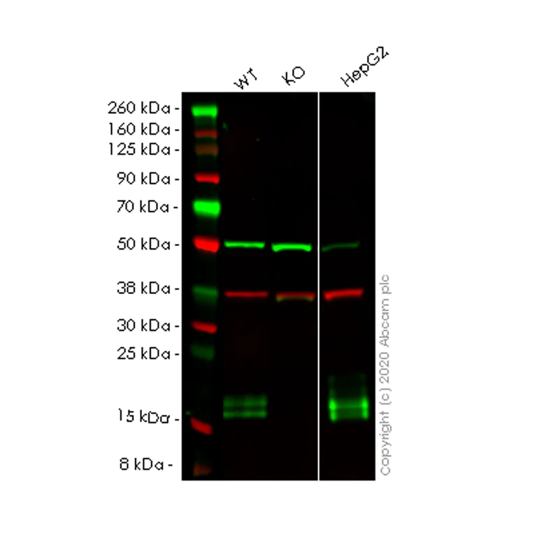 Western blot - Anti-Niemann Pick C2 antibody [EPR19993] - Low endotoxin, Azide free (AB223550)