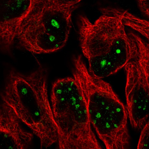 Immunocytochemistry/ Immunofluorescence - Anti-NIFK antibody [CL2240] - Nucleolar Marker (AB211871)
