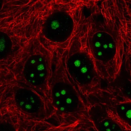 Immunocytochemistry/ Immunofluorescence - Anti-NIFK antibody [CL2240] - Nucleolar Marker (AB211871)
