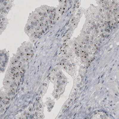 Immunohistochemistry (Formalin/PFA-fixed paraffin-embedded sections) - Anti-NIFK antibody [CL2240] - Nucleolar Marker (AB211871)