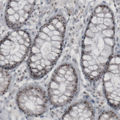 Immunohistochemistry (Formalin/PFA-fixed paraffin-embedded sections) - Anti-NIFK antibody [CL2240] - Nucleolar Marker (AB211871)