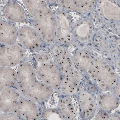 Immunohistochemistry (Formalin/PFA-fixed paraffin-embedded sections) - Anti-NIFK antibody [CL2240] - Nucleolar Marker (AB211871)