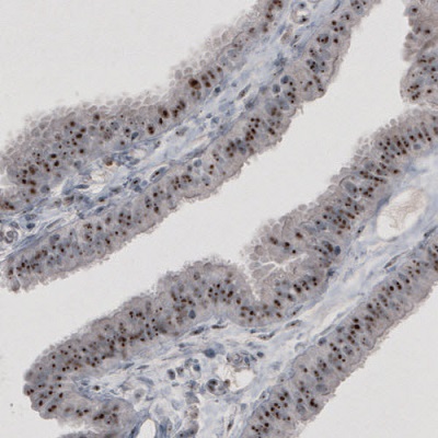 Immunohistochemistry (Formalin/PFA-fixed paraffin-embedded sections) - Anti-NIFK antibody [CL2240] - Nucleolar Marker (AB211871)