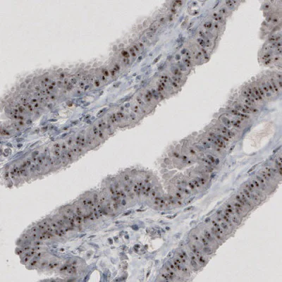 Immunohistochemistry (Formalin/PFA-fixed paraffin-embedded sections) - Anti-NIFK antibody [CL2240] - Nucleolar Marker (AB211871)