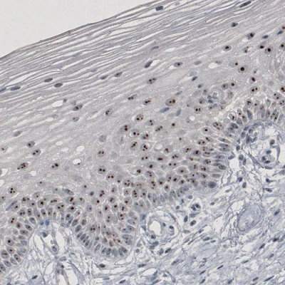 Immunohistochemistry (Formalin/PFA-fixed paraffin-embedded sections) - Anti-NIFK antibody [CL2240] - Nucleolar Marker (AB211871)