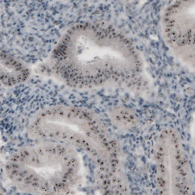 Immunohistochemistry (Formalin/PFA-fixed paraffin-embedded sections) - Anti-NIFK antibody [CL2240] - Nucleolar Marker (AB211871)