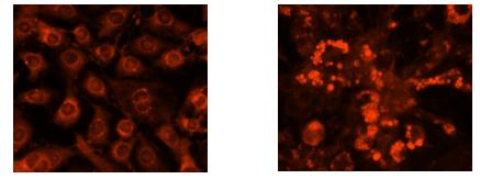 Fluorescence Microscopy - Nile Red Staining Kit (AB228553), expandable thumbnail