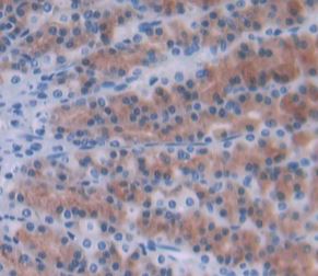 Immunohistochemistry (Formalin/PFA-fixed paraffin-embedded sections) - Anti-Ninein/NIN antibody (AB231181), expandable thumbnail