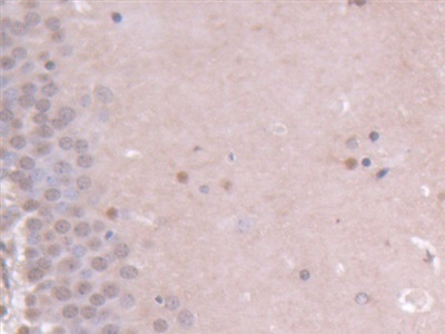 Immunohistochemistry (Formalin/PFA-fixed paraffin-embedded sections) - Anti-Ninein/NIN antibody (AB231181), expandable thumbnail