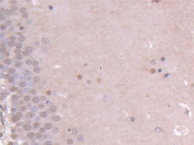 Immunohistochemistry (Formalin/PFA-fixed paraffin-embedded sections) - Anti-Ninein/NIN antibody (AB231181)