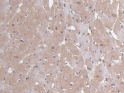 Immunohistochemistry (Formalin/PFA-fixed paraffin-embedded sections) - Anti-Ninein/NIN antibody (AB231181), expandable thumbnail