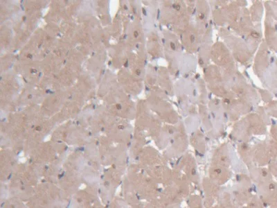 Immunohistochemistry (Formalin/PFA-fixed paraffin-embedded sections) - Anti-Ninein/NIN antibody (AB231181)