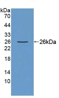 Western blot - Anti-Ninein/NIN antibody (AB231181)