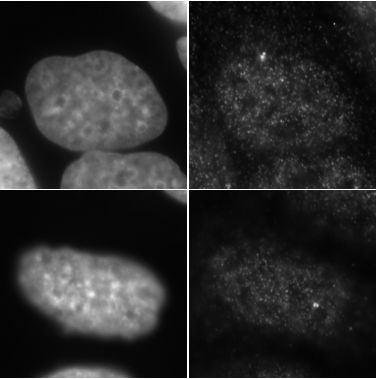 Immunocytochemistry/ Immunofluorescence - Anti-Ninein/NIN antibody - Centrosome Marker (AB4447), expandable thumbnail