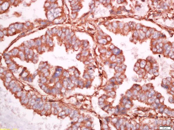 Immunohistochemistry (Formalin/PFA-fixed paraffin-embedded sections) - Anti-Ninjurin 1 antibody (AB213695)