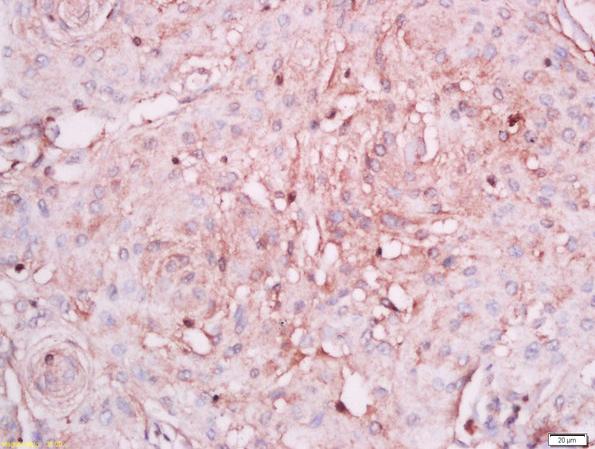 Immunohistochemistry (Formalin/PFA-fixed paraffin-embedded sections) - Anti-Ninjurin 1 antibody (AB213695)