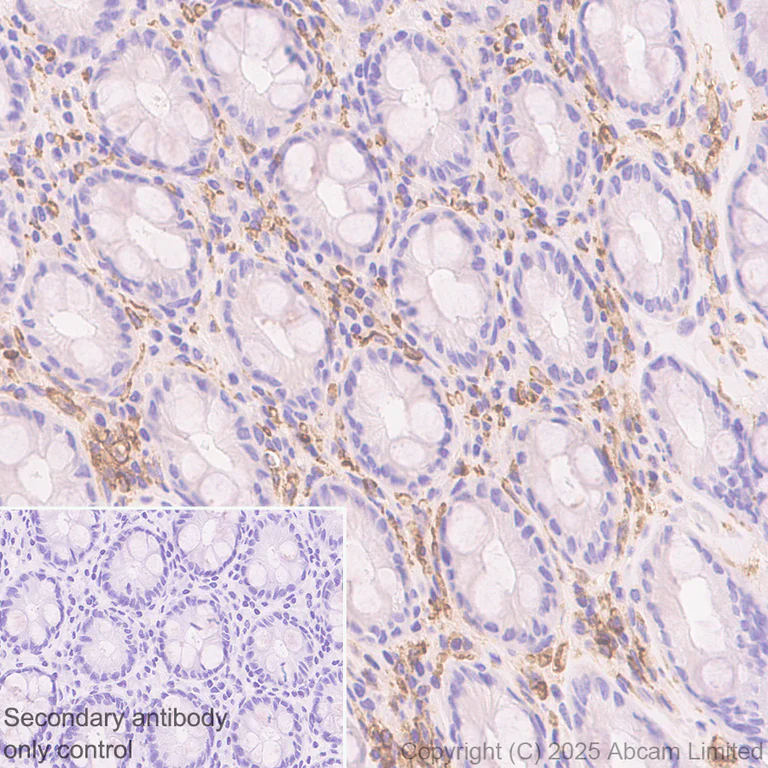 Immunohistochemistry (Formalin/PFA-fixed paraffin-embedded sections) - Anti-Ninjurin -1 antibody [EPR30446-757] - BSA and Azide free (AB326606)