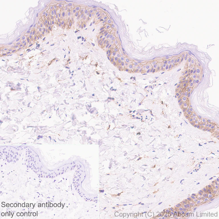 Immunohistochemistry (Formalin/PFA-fixed paraffin-embedded sections) - Anti-Ninjurin -1 antibody [EPR30446-757] - BSA and Azide free (AB326606)