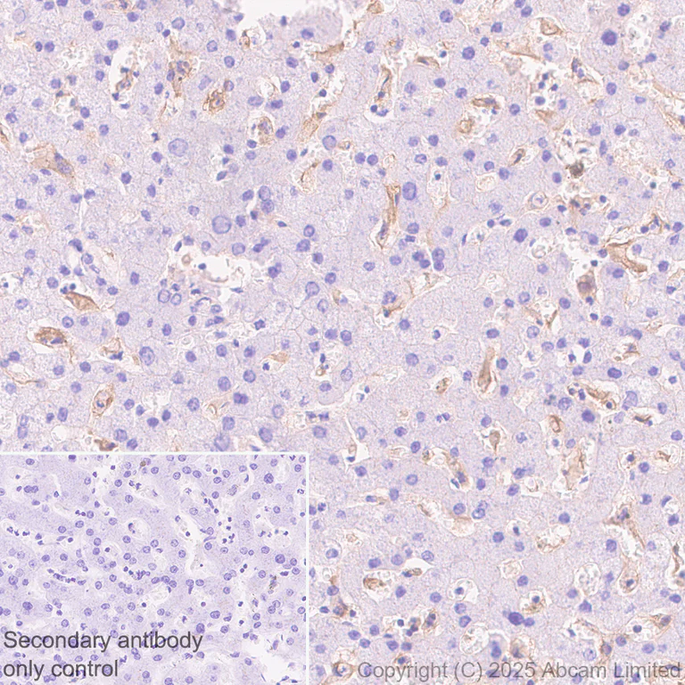 Immunohistochemistry (Formalin/PFA-fixed paraffin-embedded sections) - Anti-Ninjurin -1 antibody [EPR30446-757] - BSA and Azide free (AB326606)