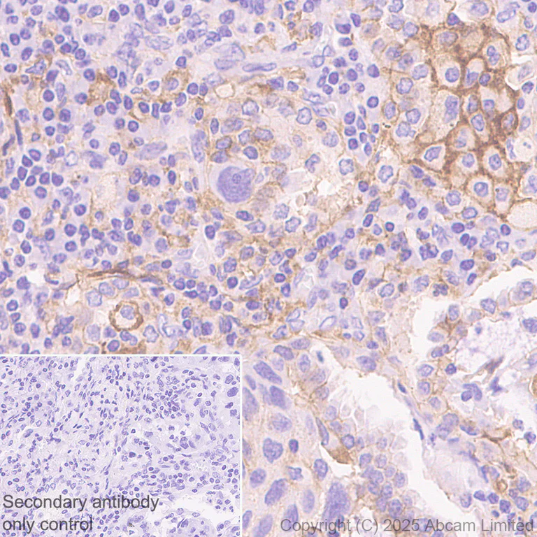 Immunohistochemistry (Formalin/PFA-fixed paraffin-embedded sections) - Anti-Ninjurin -1 antibody [EPR30446-757] - BSA and Azide free (AB326606)