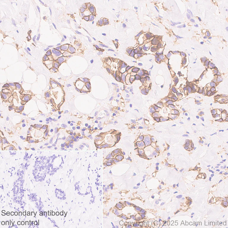 Immunohistochemistry (Formalin/PFA-fixed paraffin-embedded sections) - Anti-Ninjurin -1 antibody [EPR30446-757] - BSA and Azide free (AB326606)