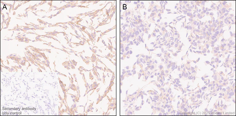 Immunohistochemistry (Formalin/PFA-fixed paraffin-embedded sections) - Anti-Ninjurin -1 antibody [EPR30446-757] - BSA and Azide free (AB326606)
