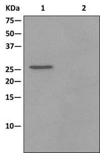 Immunoprecipitation - Anti-Ninjurin2 antibody [EPR12038] (AB172627), expandable thumbnail