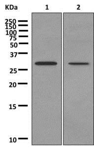 Western blot - Anti-Ninjurin2 antibody [EPR12038] (AB172627), expandable thumbnail