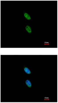 Immunocytochemistry/ Immunofluorescence - Anti-NIPA antibody (AB154553), expandable thumbnail