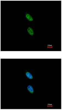 Immunocytochemistry/ Immunofluorescence - Anti-NIPA antibody (AB154553)