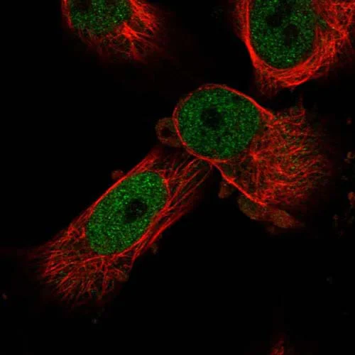 Immunocytochemistry/ Immunofluorescence - Anti-NIPA1 antibody (AB121744)