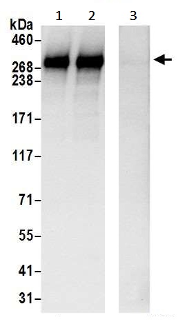 Immunoprecipitation - Anti-NIPBL antibody (AB245539)