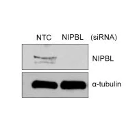 Western blot - Anti-NIPBL antibody [KT55] (AB106768)