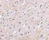 Immunohistochemistry (Formalin/PFA-fixed paraffin-embedded sections) - Anti-NIPSNAP1 antibody (AB67324)