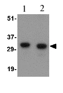 Western blot - Anti-NIPSNAP1 antibody (AB67324)