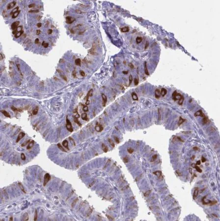 Immunohistochemistry (Formalin/PFA-fixed paraffin-embedded sections) - Anti-NIR2 antibody (AB254959)