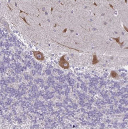 Immunohistochemistry (Formalin/PFA-fixed paraffin-embedded sections) - Anti-NIR2 antibody (AB254959)
