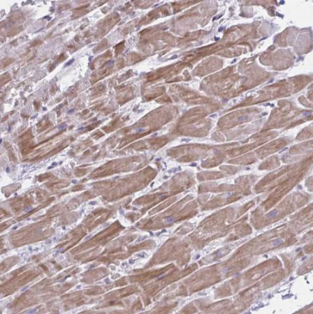 Immunohistochemistry (Formalin/PFA-fixed paraffin-embedded sections) - Anti-NIR2 antibody (AB254959)
