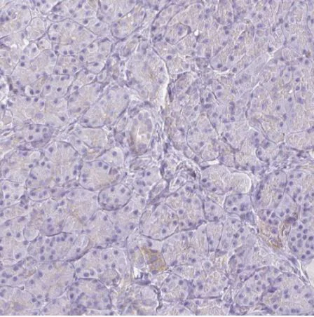 Immunohistochemistry (Formalin/PFA-fixed paraffin-embedded sections) - Anti-NIR2 antibody (AB254959)